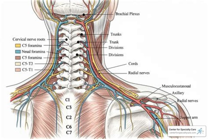 How is a pinched nerve diagnosed?