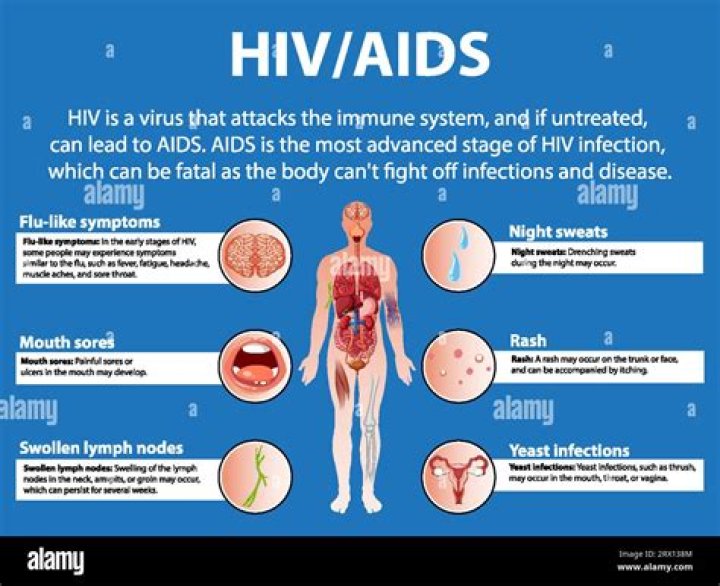 How is HIV different from other retroviruses?