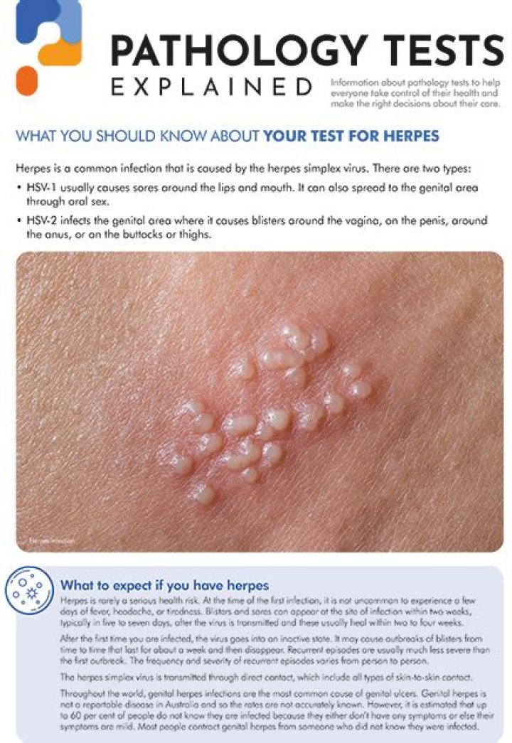 How long can you have herpes without knowing?