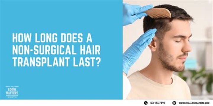 How long does a non surgical hair replacement last?