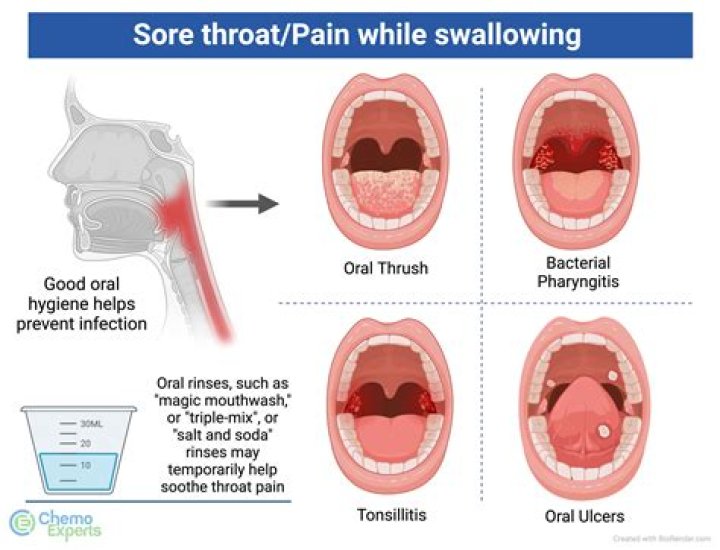 How long does it take for a sore throat to heal?