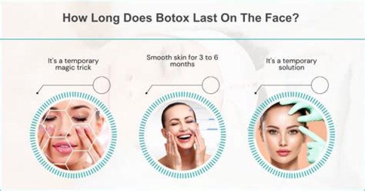 How long does it take for Botox to work on frown lines?