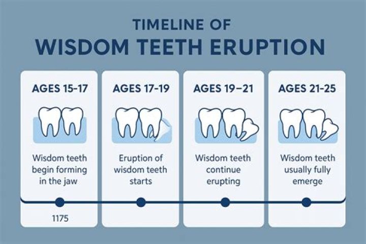 How long does it take for wisdom teeth to erupt?