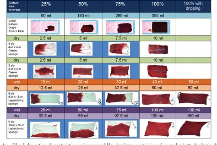 How much blood loss is classed as a hemorrhage?