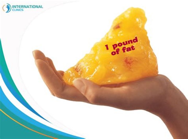 How much fat can liposuction remove?