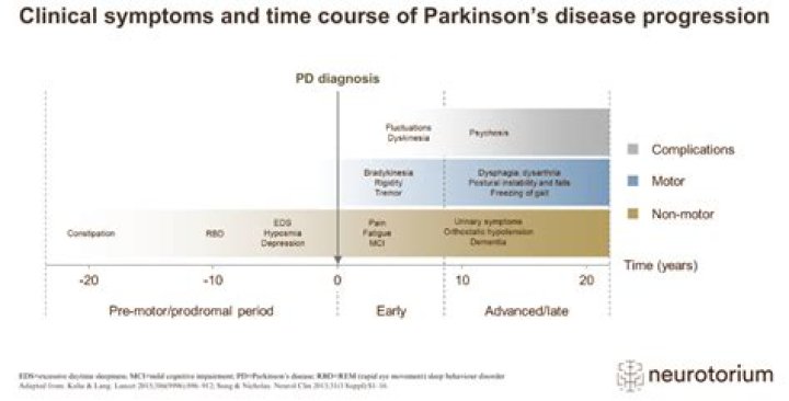 How quickly does Parkinson's dementia progress?