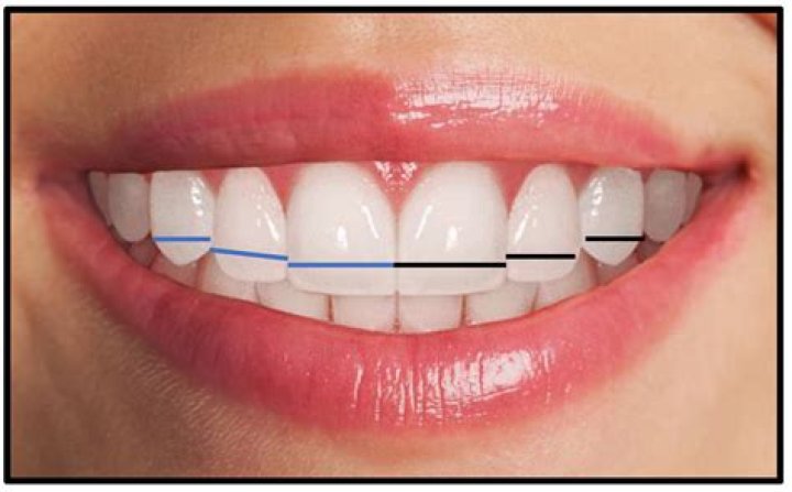 How should teeth be shaped?