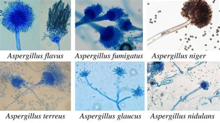 Is Aspergillus niger harmful? | ContextResponse.com