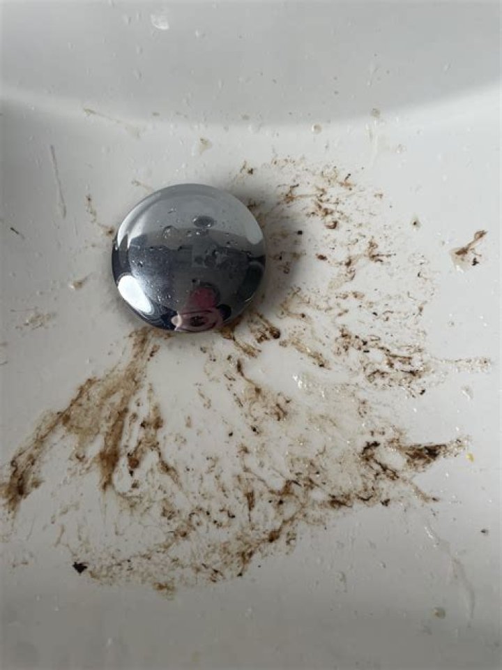 Is coffee ground vomit an emergency?
