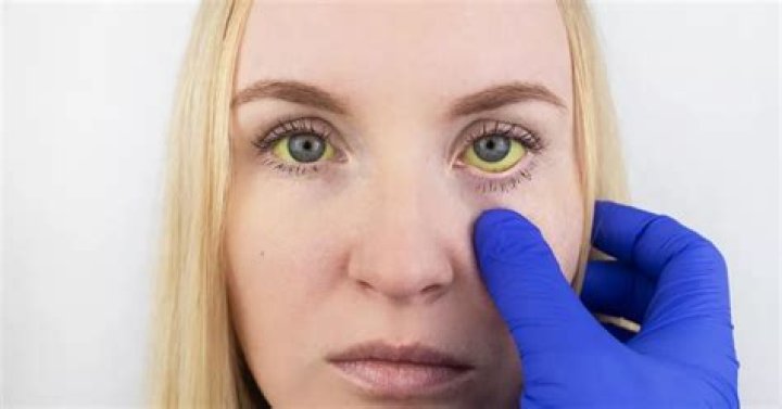 Is hepatitis contagious through air?