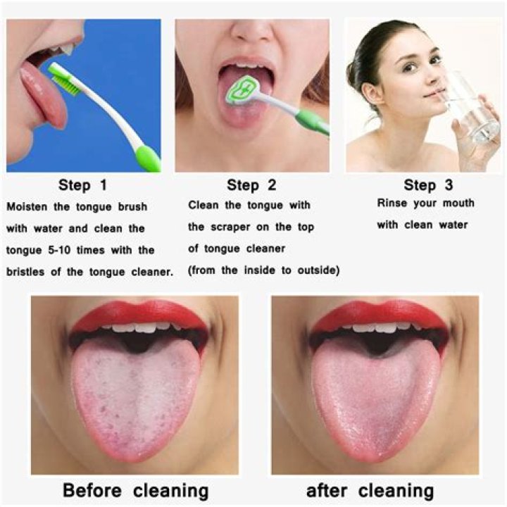Is it bad to brush your tongue?
