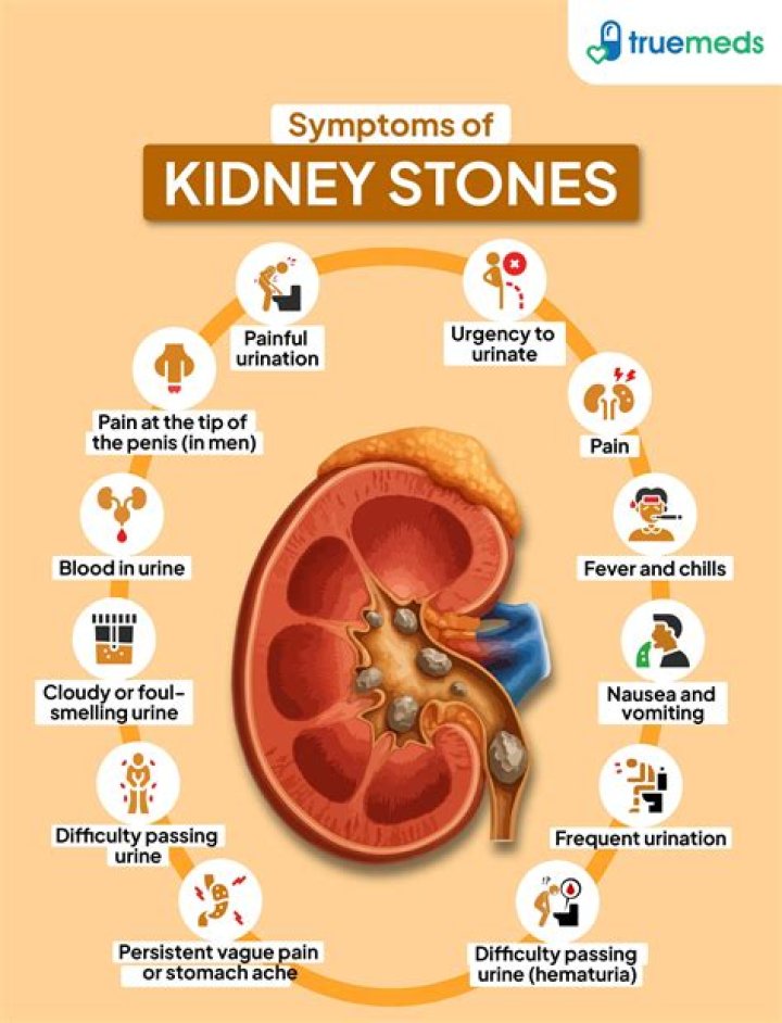 Is kidney stones the worst pain ever?