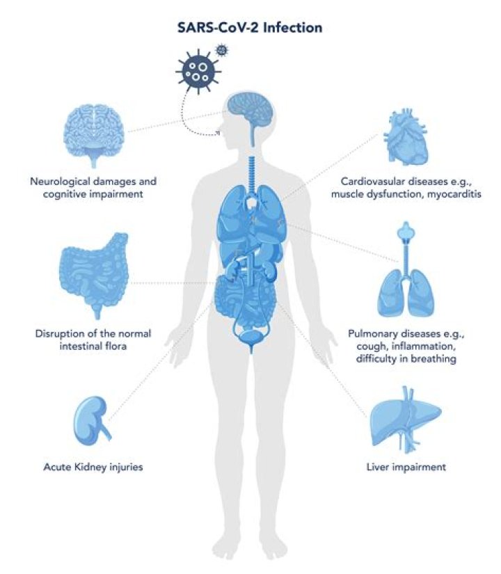 Is SARS an emerging disease?