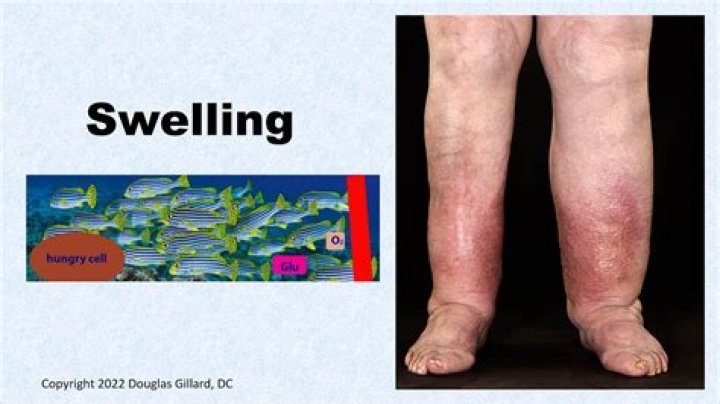 Is swelling a sign of infection?