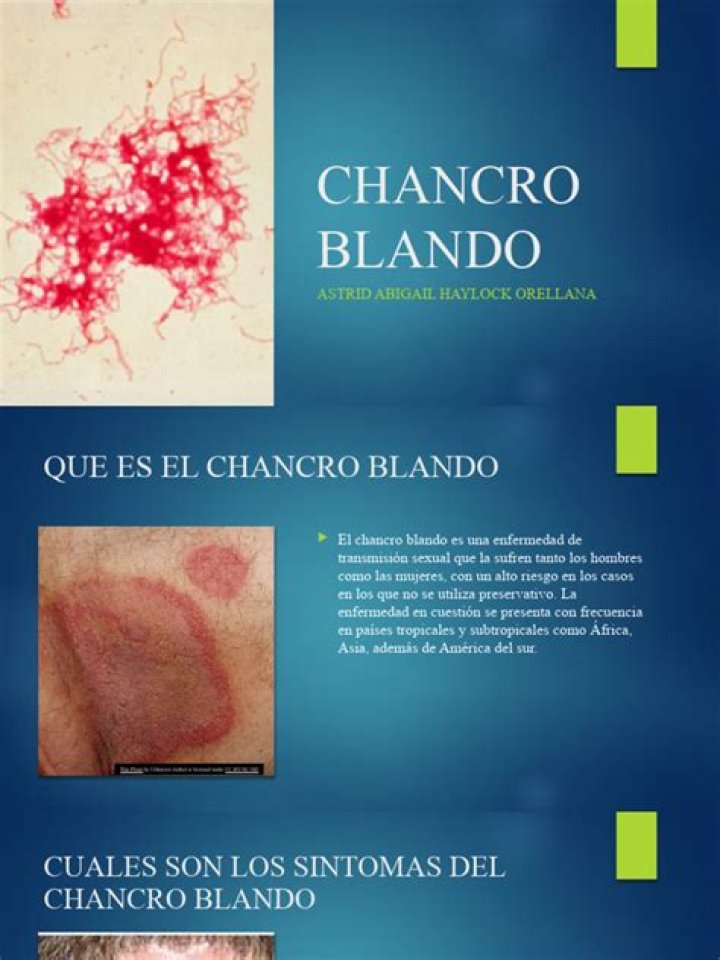 ¿Qué pasa si no se trata el chancro blando?