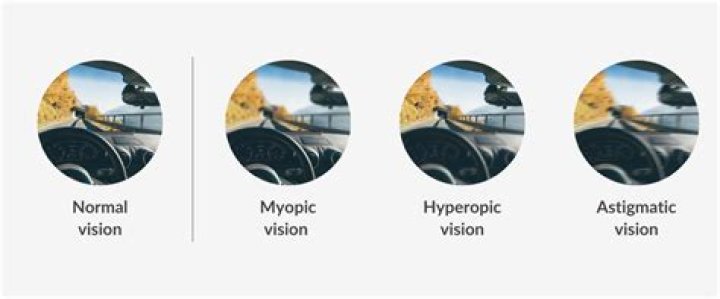 What's the worst eyesight you can have?