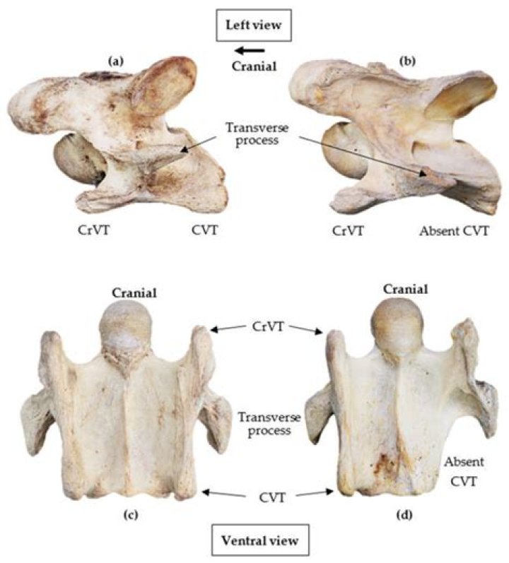 What are cervical vertebrae? | ContextResponse.com