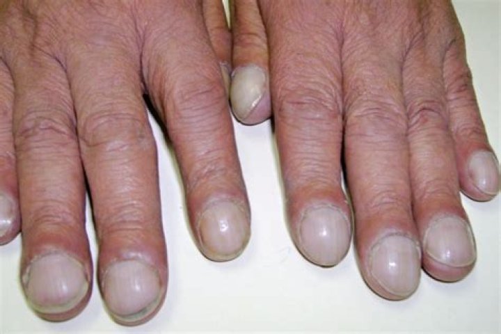 What are finger nails made of?