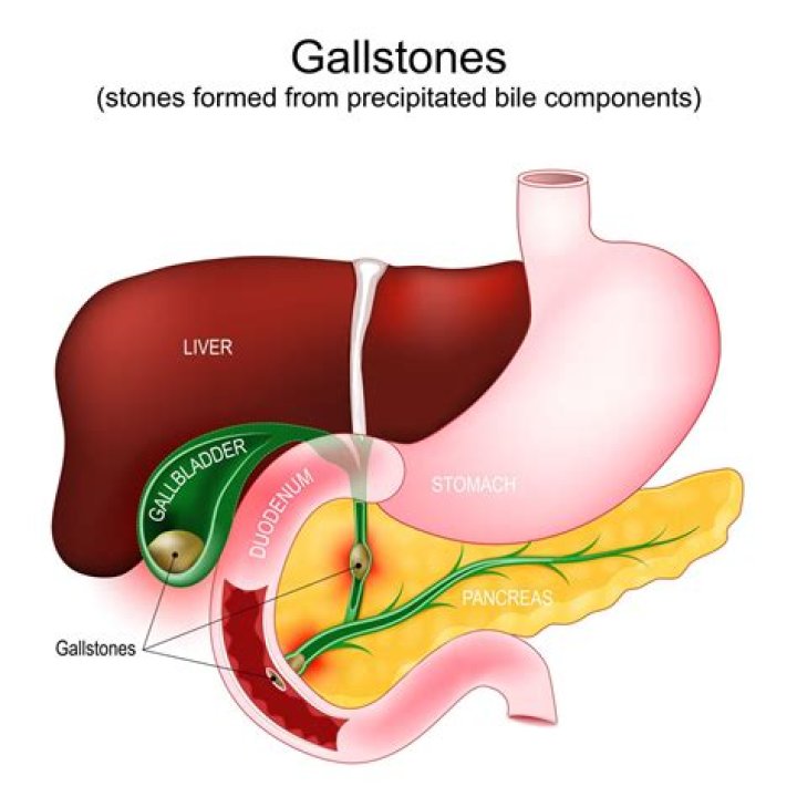 What are liver diseases? | ContextResponse.com