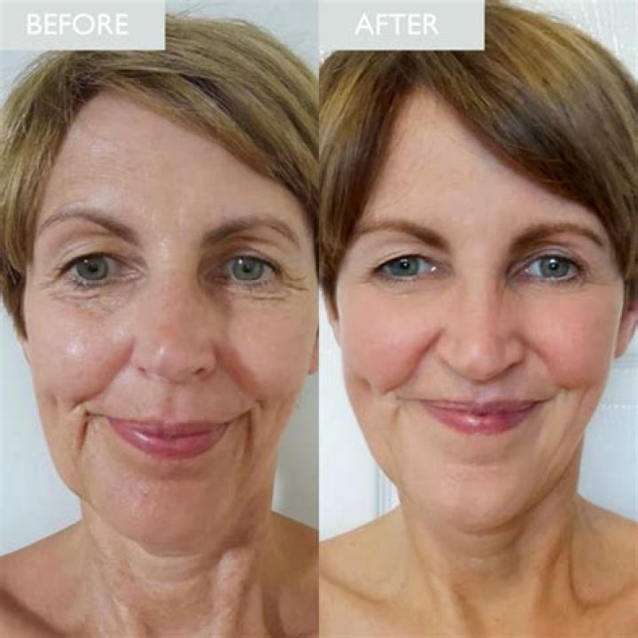 What are the benefits of night cream?