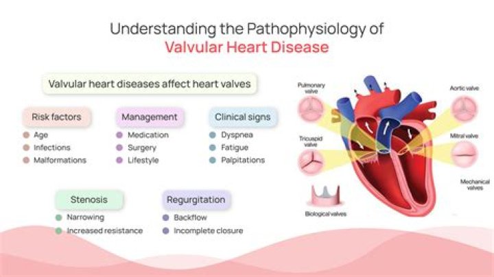 What are the causes of valvular heart disease?