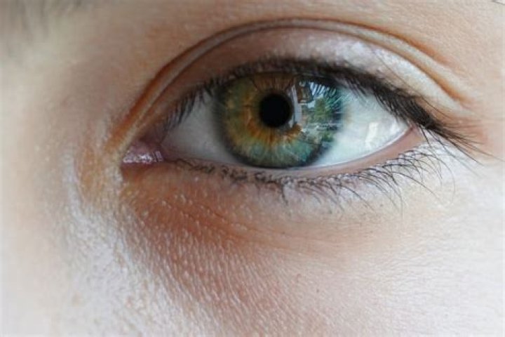 What are the stages of eye cancer?