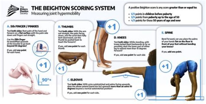 What can hypermobility be a symptom of?