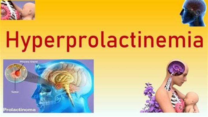 What caused my hyperprolactinemia?