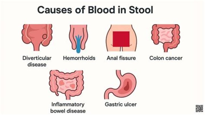 What causes bright red blood in stool and stomach pain?