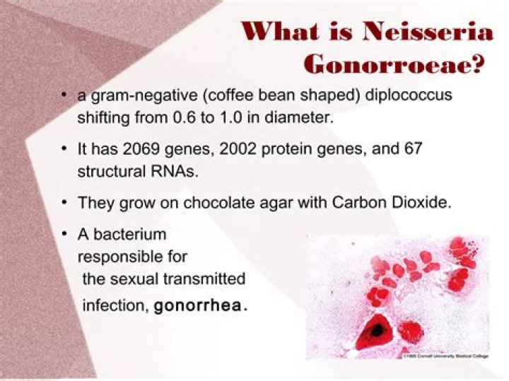 What causes Diplococcus? | ContextResponse.com