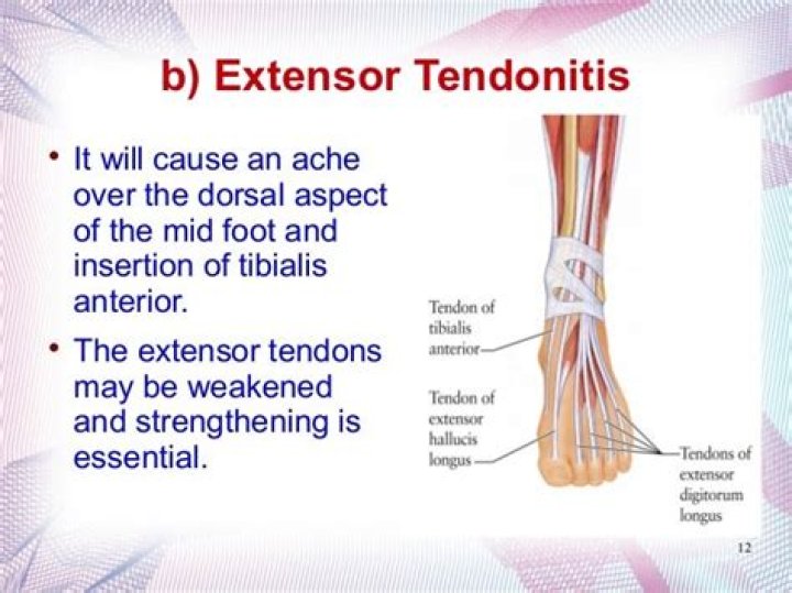 What causes extensor tendonitis?