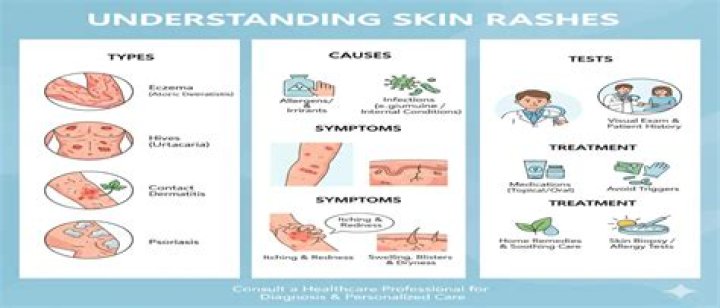 What causes skin rash? | ContextResponse.com