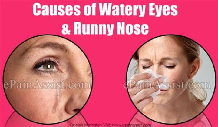 What causes watery eyes and runny nose?