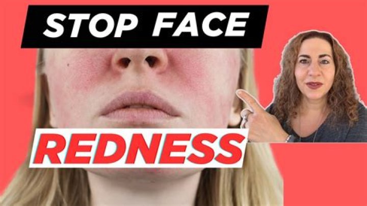 What causes your face to turn red?