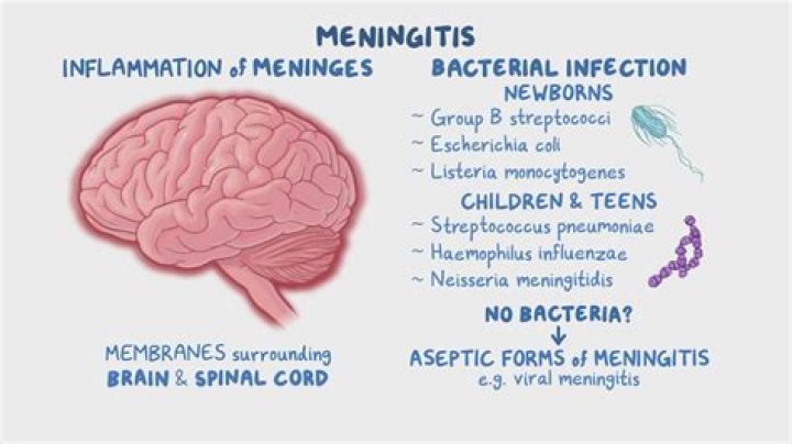 What color is CSF in bacterial meningitis?