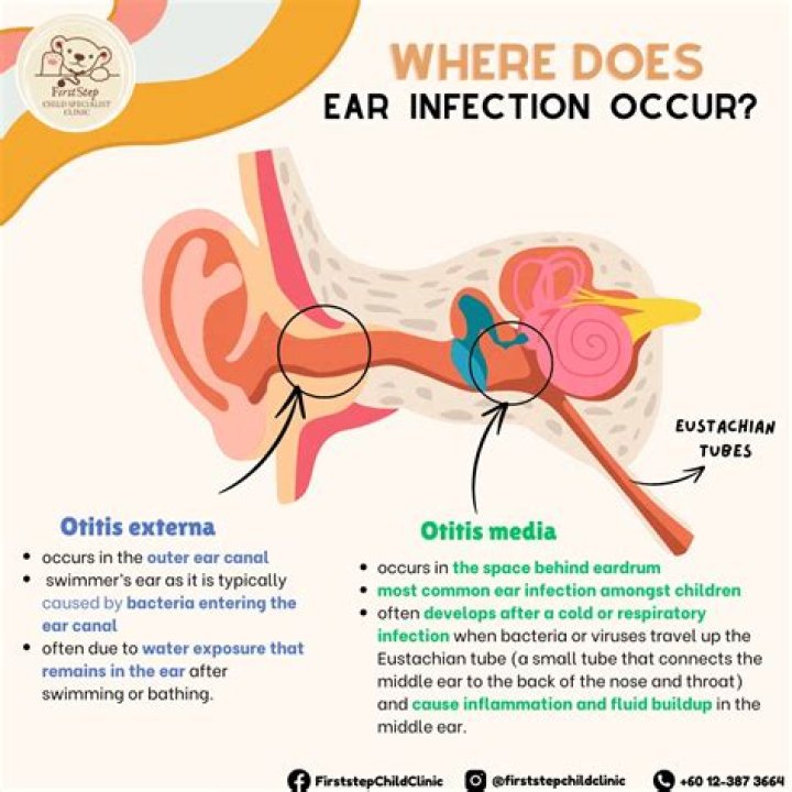 What color is ear wax when you have an ear infection?