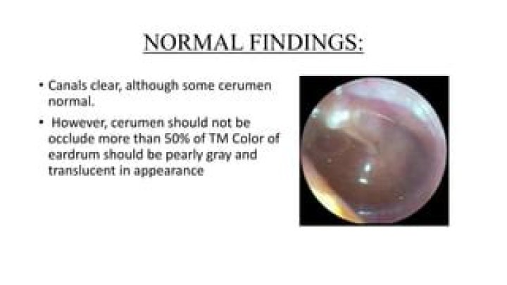 What color is the tympanic membrane?