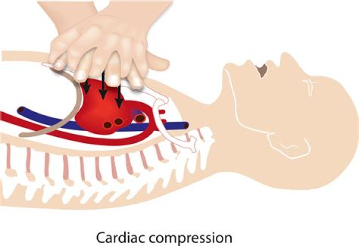 What do chest compressions do?