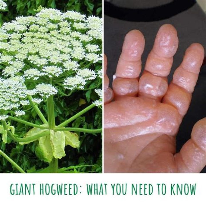 What do you do if you touch hogweed?