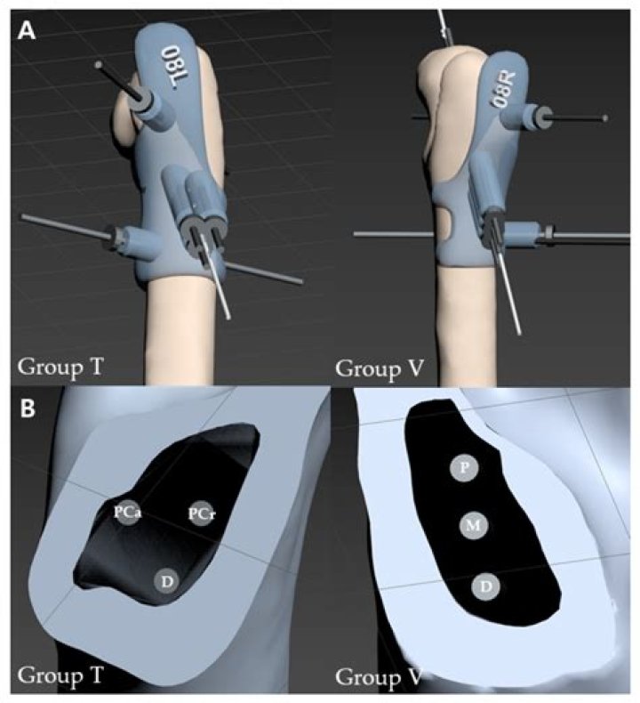 What does cartilage mean in medical terms?