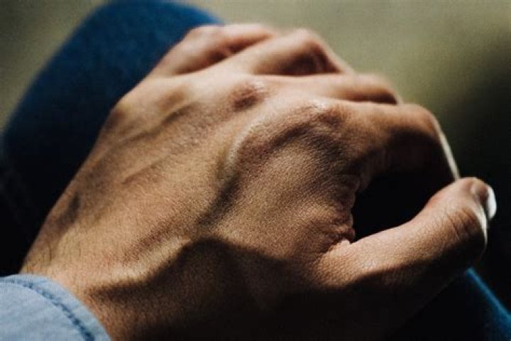What does it mean when your veins are very visible?