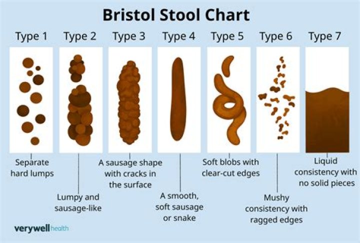 What does loose screw mean?