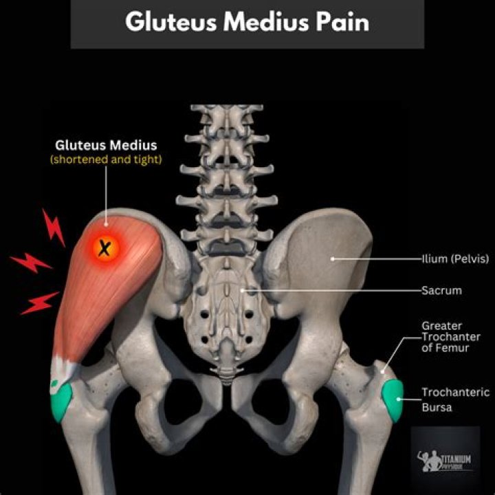 What does the gluteus medius muscle do?