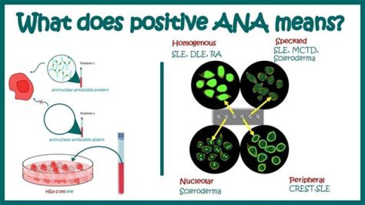 What does the prefix Ana mean in biology?