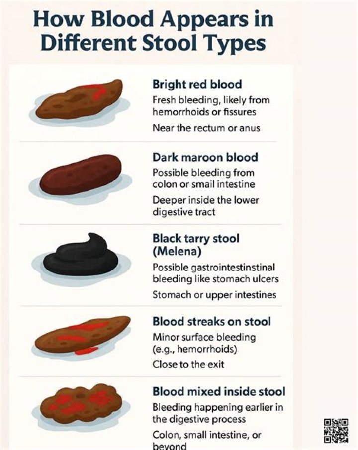 What does yeast in stool mean?