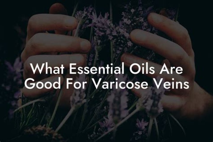 What essential oil is good for varicose veins?