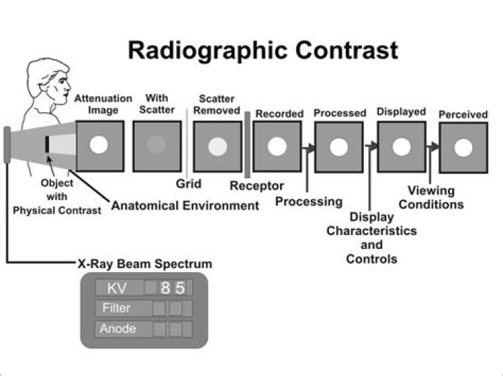 What factors affect radiographic contrast?