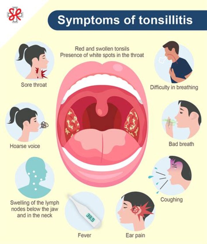 What foods cure tonsillitis?