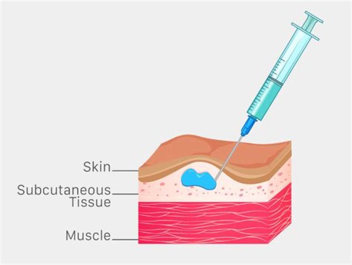 What gauge is used for subcutaneous injections?