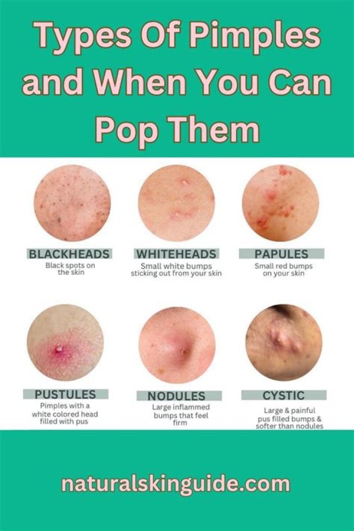 What happens after you pop a pimple?